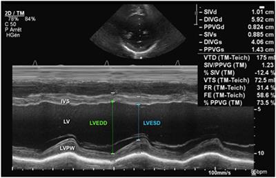 Frontiers | Echocardiographic Evaluation Of Ventricular Function—For ...